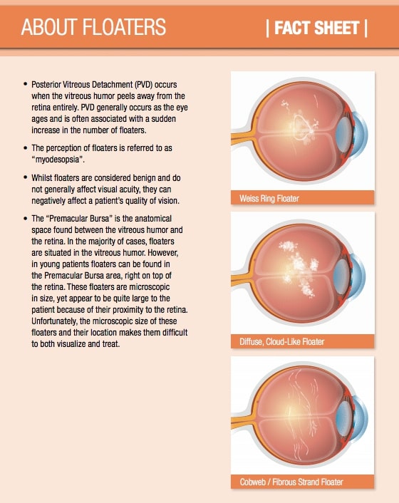 new research eye floaters