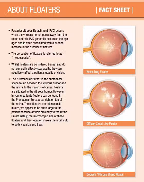 Laser Floater Treatment in Chesapeake, VA 2 floaters fact sheet2.jpg